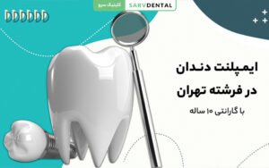 ایمپلنت دندان حرفه‌ای در فرشته تهران با بهترین قیمت و کیفیت
