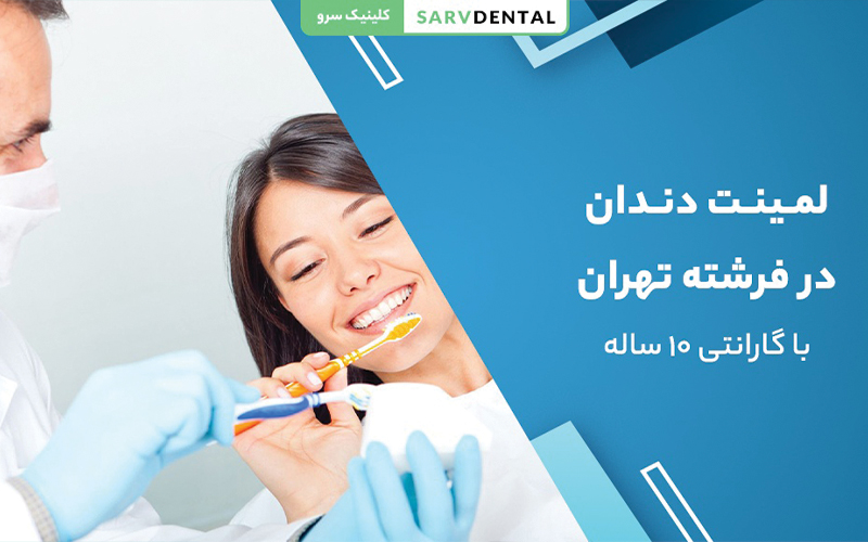 لمینت دندان در فرشته تهران با گارانتی معتبر و قیمت مناسب برای زیبایی لبخند