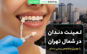 عکس لمینت دندان طبیعی در شمال تهران