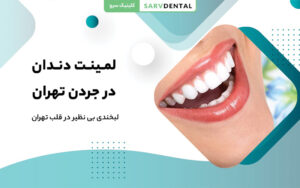 لمینت دندان در جردن تهران کلینیک سرو