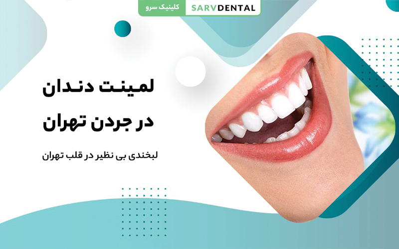 لمینت دندان در جردن تهران کلینیک سرو