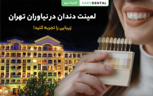 لمینت دندان در نیاوران تهران با بهترین متخصص زیبایی دندان