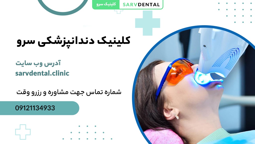 کلینیک دندانپزشکی سرو بهترین انتخاب برای بلیچینگ دندان در تهران