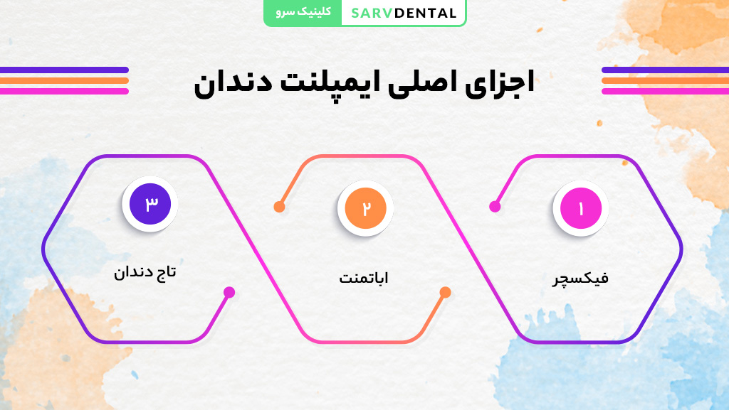 اجزای اصلی ایمپلنت دندان