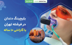 بلیچینگ دندان در کلینیک تخصصی دندانپزشکی سرو