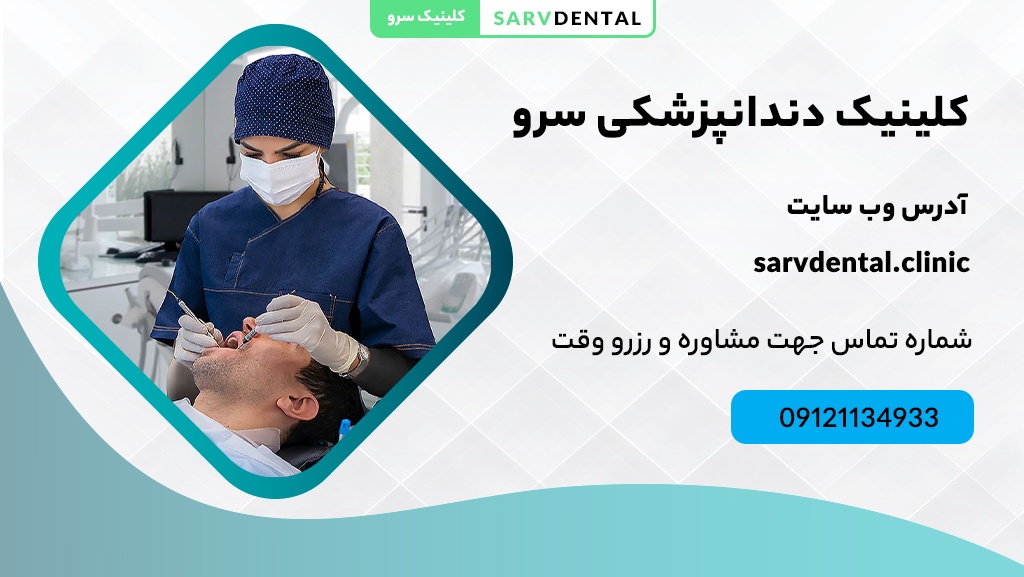 بلیچینگ تخصصی دندان در جردن تهران توسط کلینیک دندانپزشکی سرو
