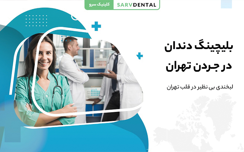 بلیچینگ دندان حرفهای در جردن تهران با بهترین مواد سفیدکننده