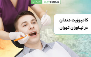 کامپوزیت دندان طبیعی و زیبا در نیاوران تهران با بهترین دندانپزشک زیبایی
