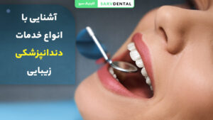 آشنایی با انواع خدمات دندانپزشکی زیبایی