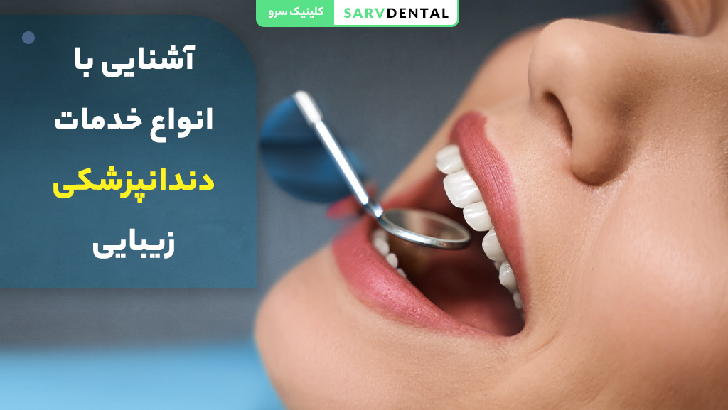 آشنایی با انواع خدمات دندانپزشکی زیبایی