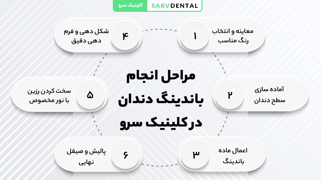 مراحل انجام باندینگ دندان در کلینیک سرو