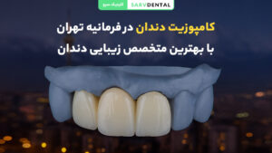 کامپوزیت دندان در فرمانیه تهران با بهترین کیفیت و ماندگاری