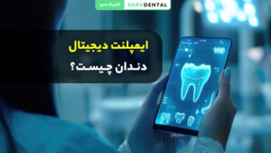 ایمپلنت دیجیتال دندان چیست و چه مزایایی دارد