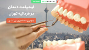 ایمپلنت دندان در فرمانیه تهران با بهترین متخصص