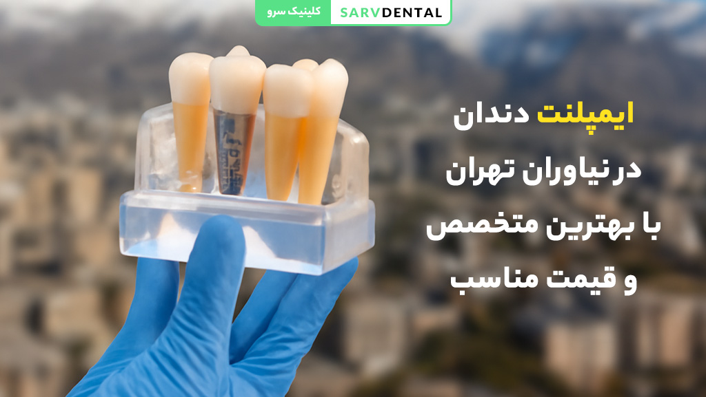 ایمپلنت دندان در نیاوران تهران با بهترین متخصص
