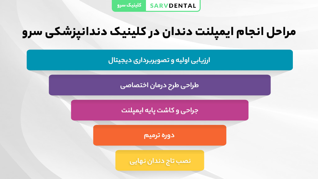 مراحل انجام ایمپلنت دندان از جراحی تا بهبودی کامل