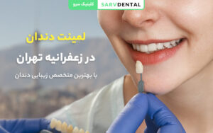 لمینت دندان در زعفرانیه تهران