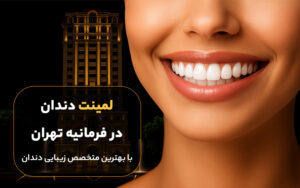 لمینت دندان در فرمانیه تهران با کیفیت بالا