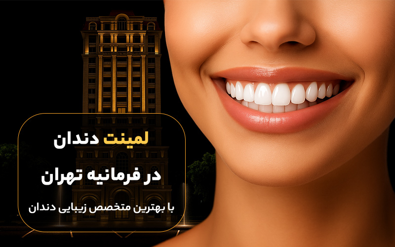 لمینت دندان در فرمانیه تهران با کیفیت بالا