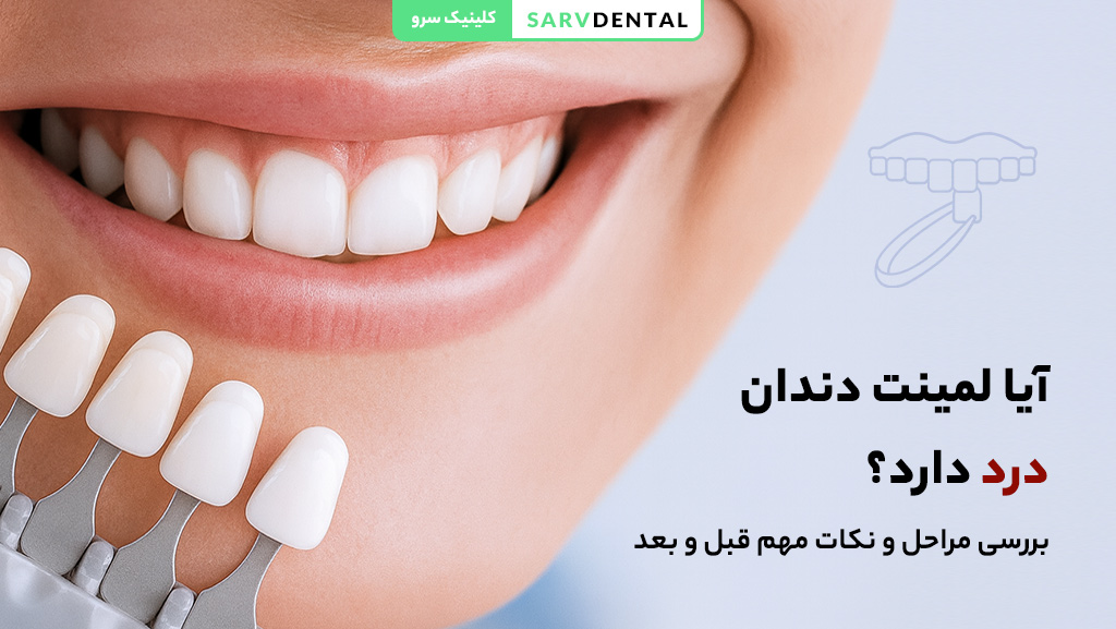 میزان درد لمینت دندان و راهکارهای کاهش آن