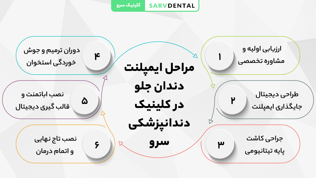 مراحل ایمپلنت دندان جلو