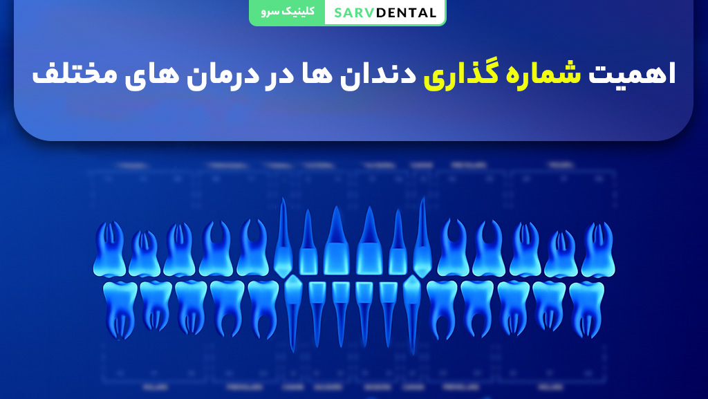 اهمیت سیستم شماره گذاری دندان‌ها
