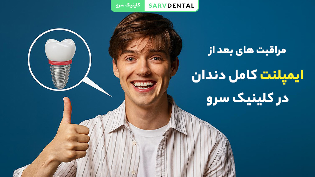 مراقبت های بعد از ایمپلنت کامل دندان
