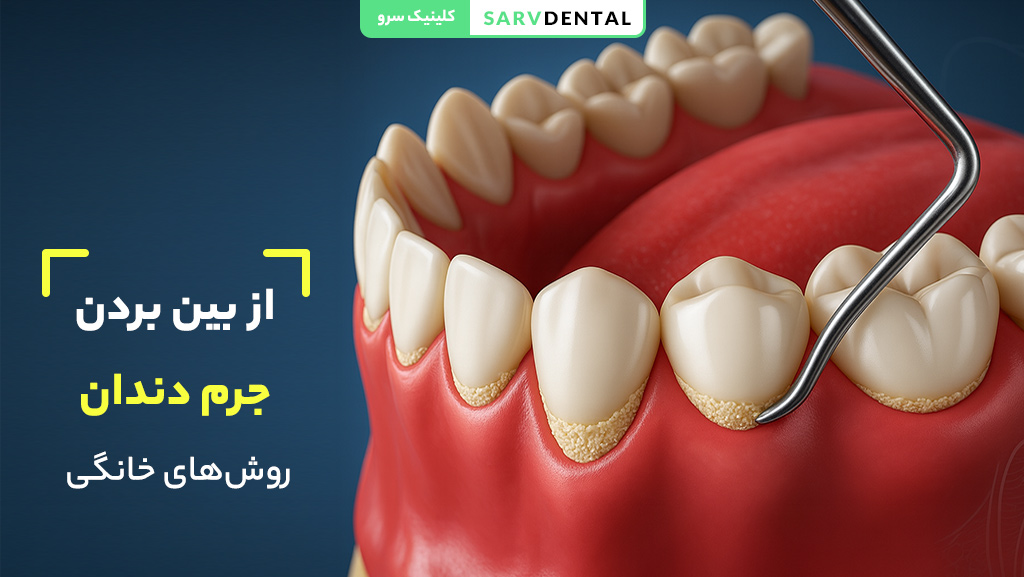 از بین بردن جرم دندان برای داشتن لبخند سفید و سالم