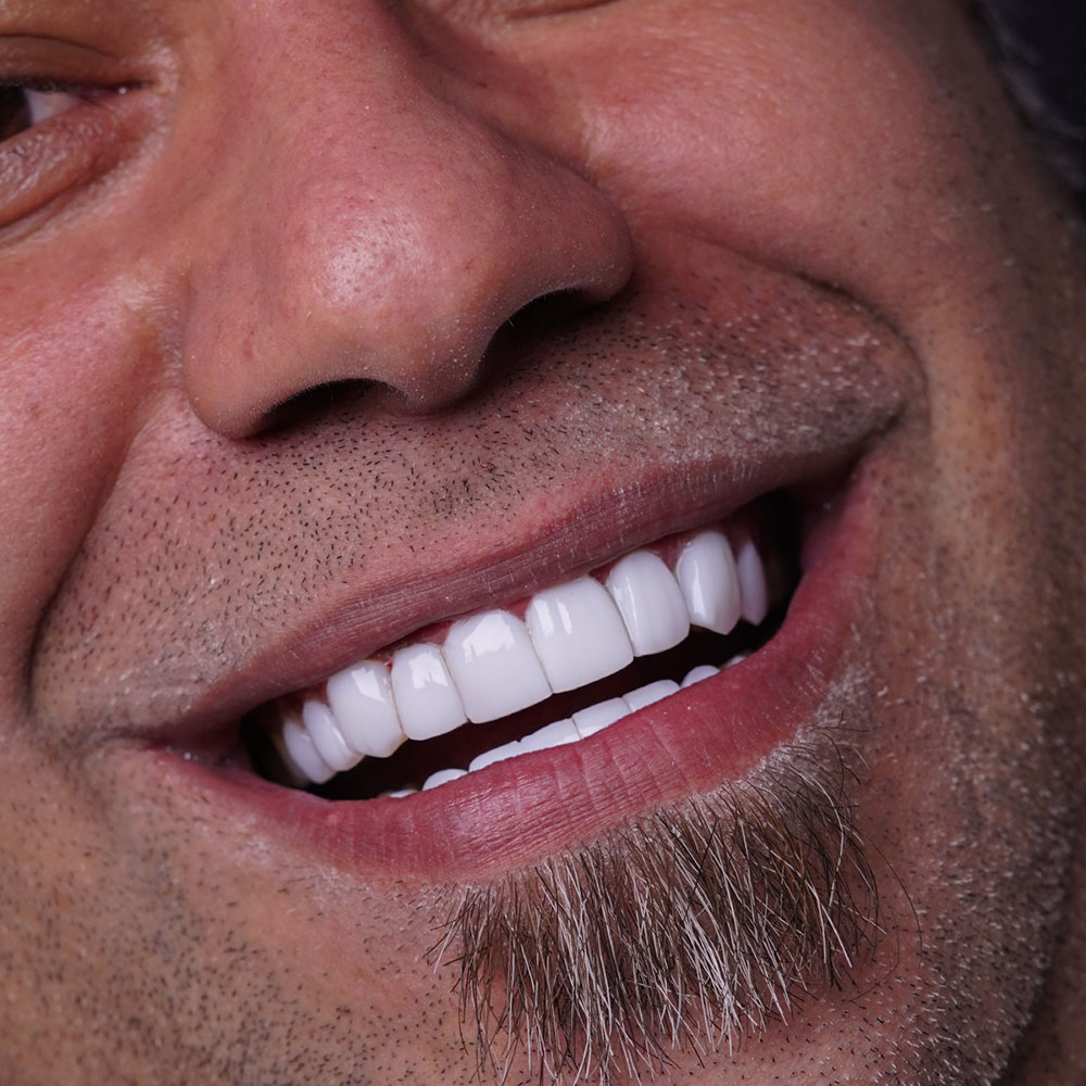 sarvdental32
