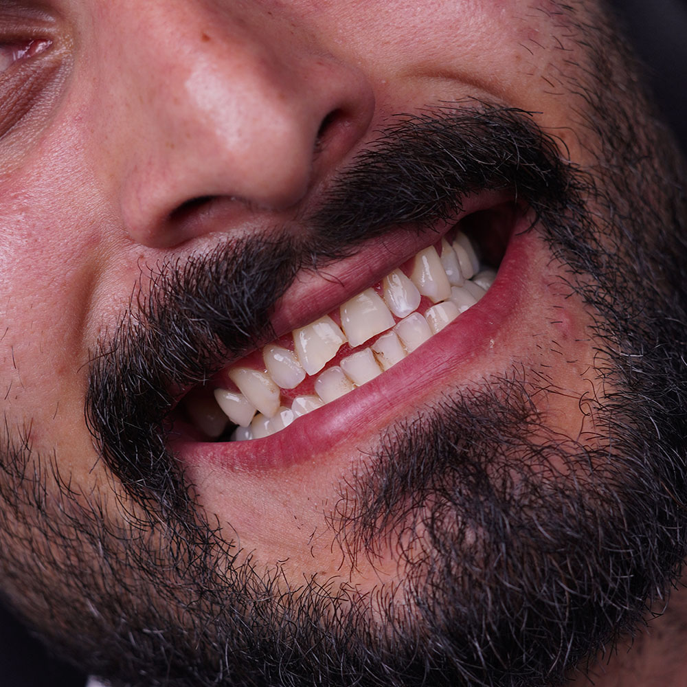 sarvdental33