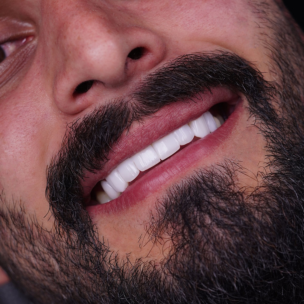 sarvdental34