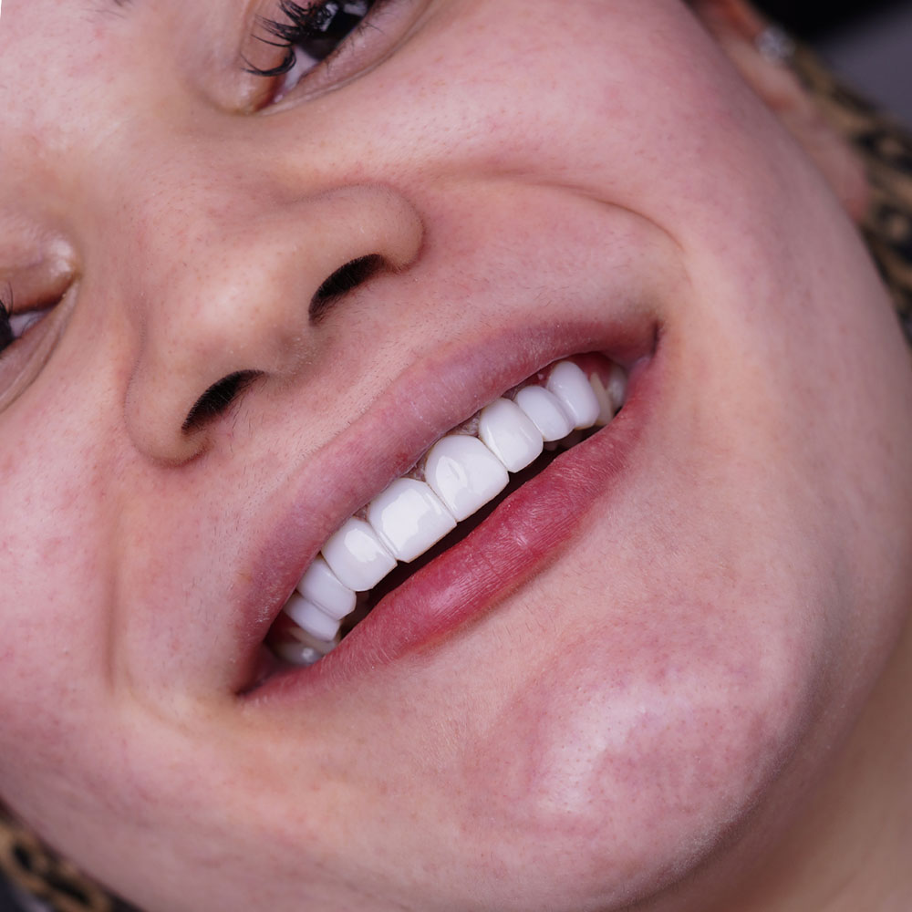 sarvdental36