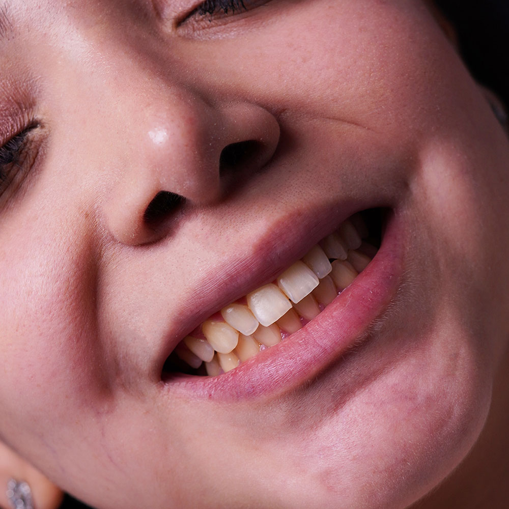 sarvdental37