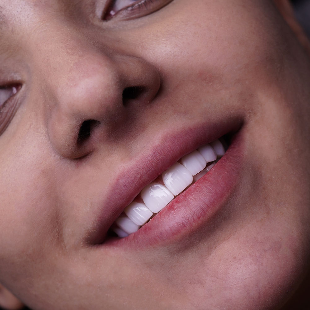 sarvdental38