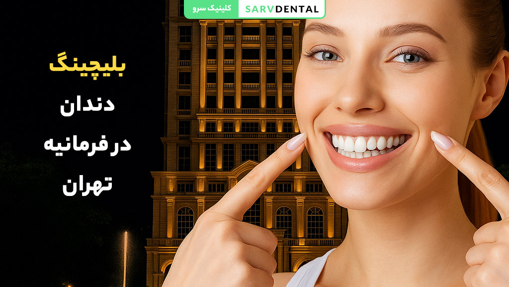 بلیچینگ دندان در فرمانیه تهران با بهترین قیمت و کیفیت