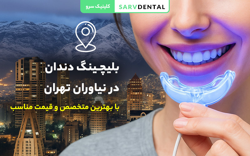 خدمات تخصصی بلیچینگ دندان در تهران