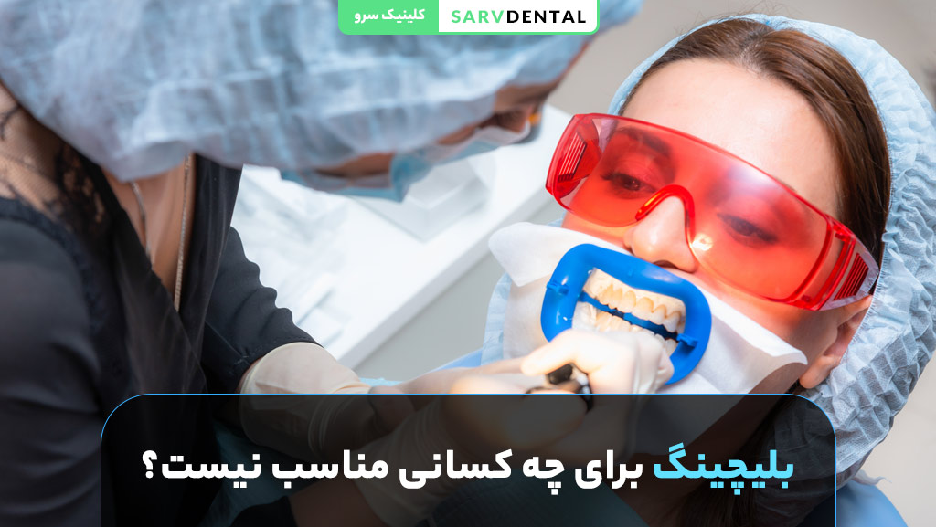 افرادی که نباید بلیچینگ دندان انجام دهند
