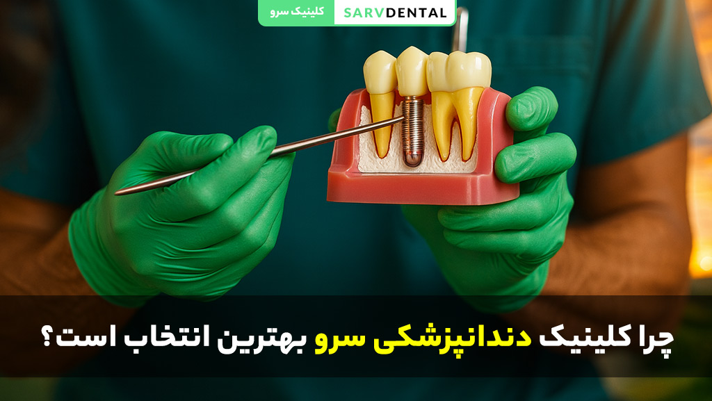 بهترین کلینیک ایمپلنت دندان در تهران کلینیک دندانپزشکی سرو با متخصصان مجرب