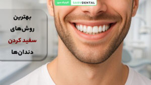 بهترین روش‌های سفید کردن دندان‌ها در کلینیک دندانپزشکی