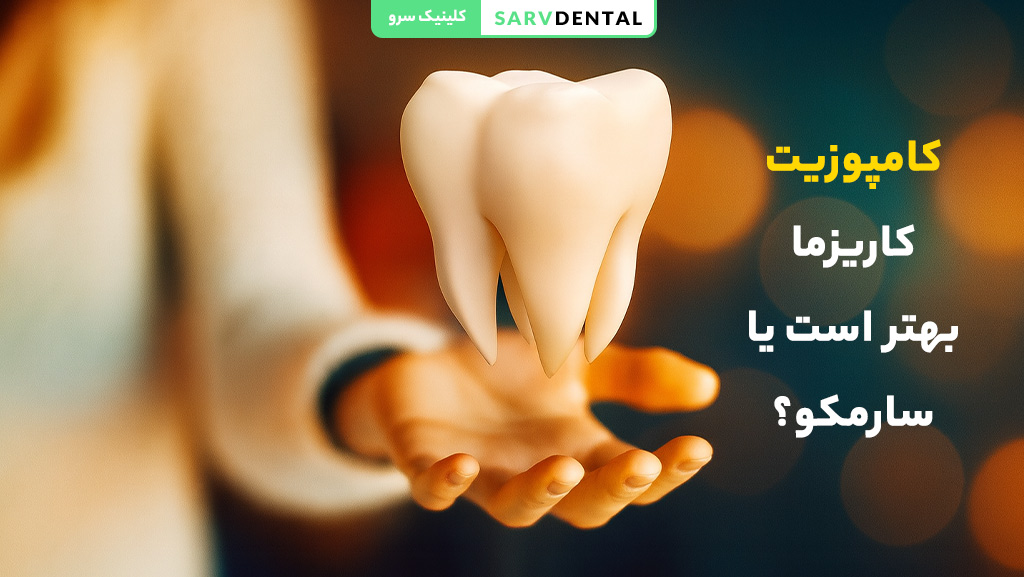کامپوزیت کاریزما بهتر است یا سارمکو؟ مقایسه کیفیت، دوام و زیبایی