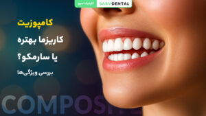 مقایسه کامپوزیت کاریزما و سارمکو؛ بررسی تفاوت‌ها و انتخاب بهترین گزینه