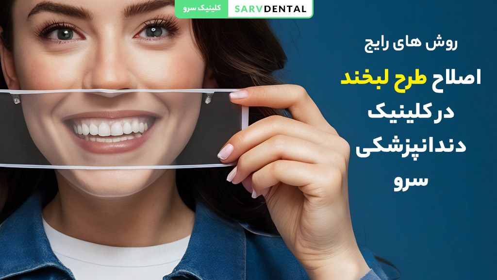 بهترین تکنیک‌های طراحی لبخند طبیعی