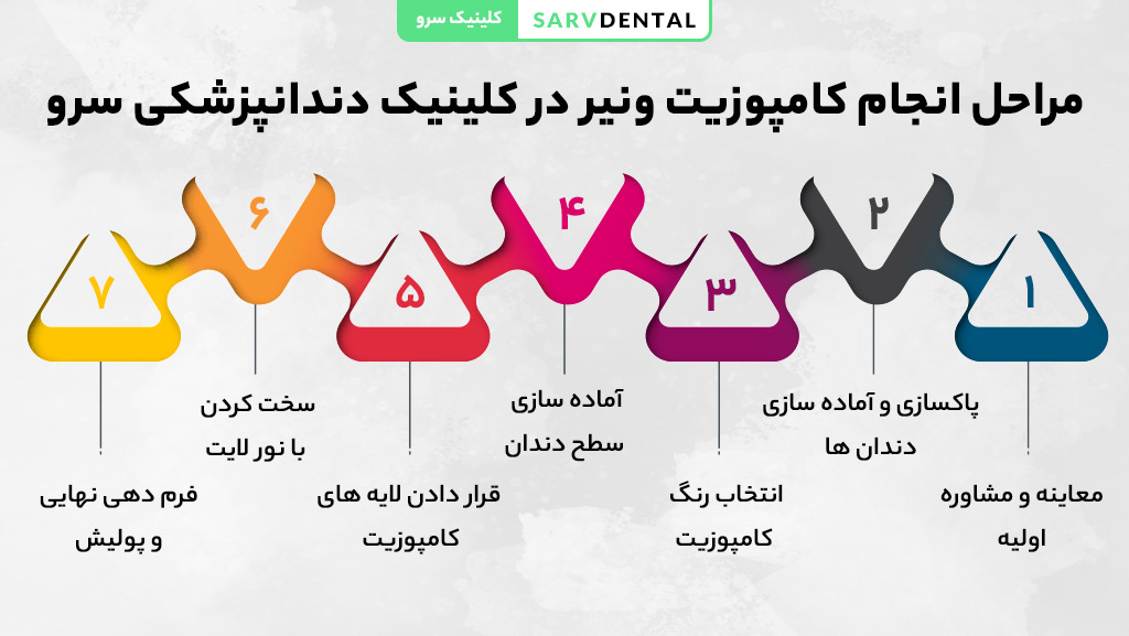 مراحل انجام کامپوزیت ونیر دندان به صورت کامل
