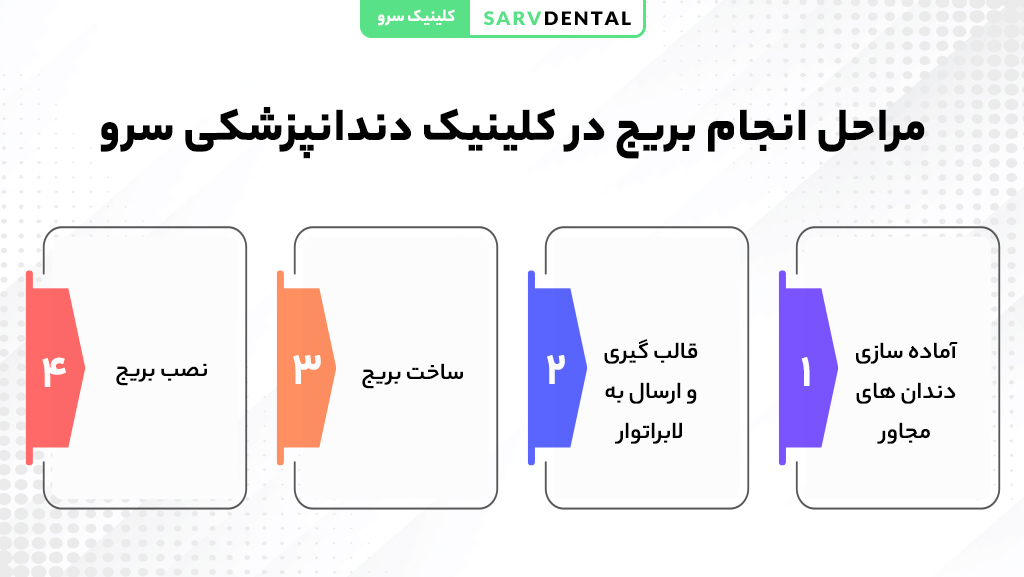 مراحل انجام بریج دندان | راهنمای نصب و درمان بریج