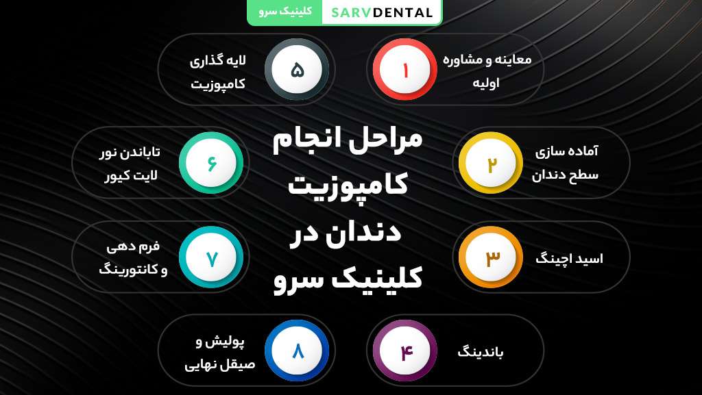 مراحل انجام کامپوزیت دندان از آماده‌سازی تا پولیش نهایی