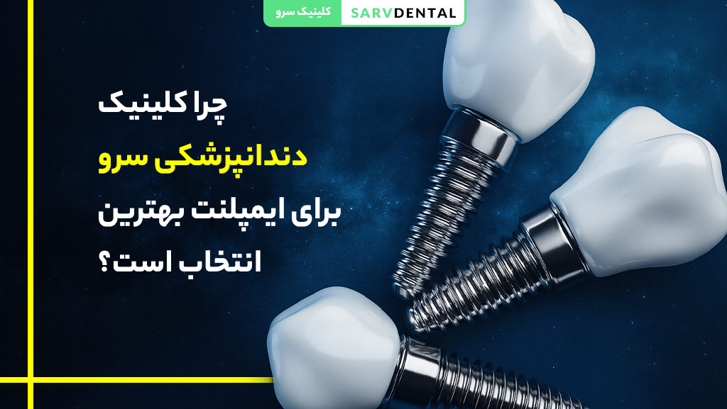چرا کلینیک دندانپزشکی سرو بهترین مرکز کاشت ایمپلنت در تهران است