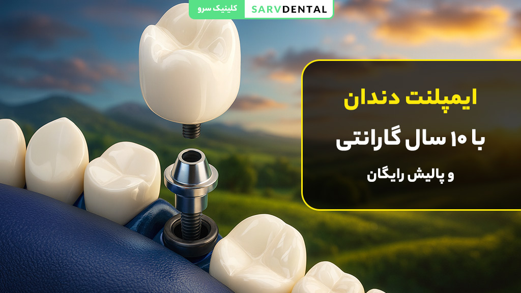 ایمپلنت دندان در تهران