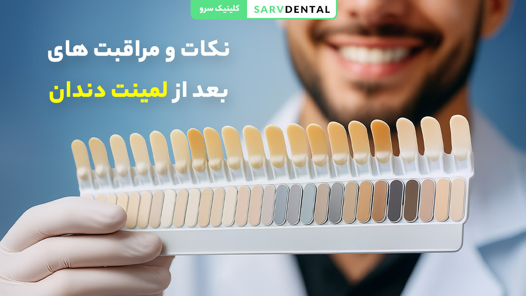 نکات مهم برای افزایش دوام لمینت