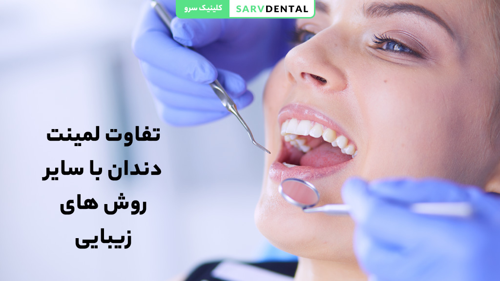 مقایسه لمینت دندان با سایر روش‌های زیبایی دندان