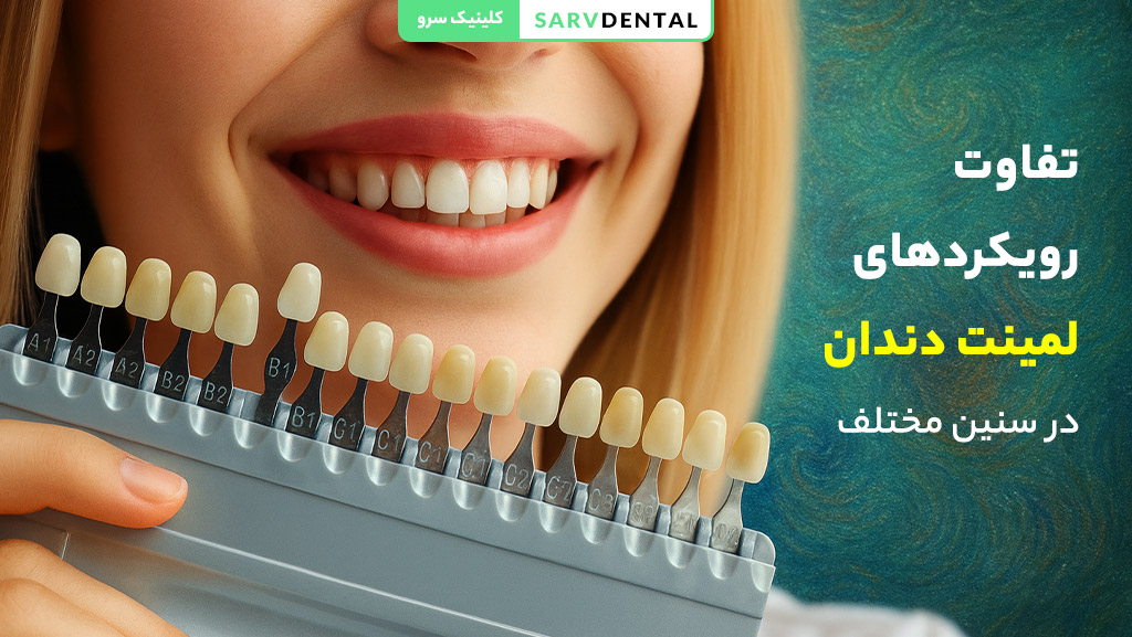 تفاوت رویکردهای لمینت دندان در سنین مختلف و انتخاب بهترین روش درمانی